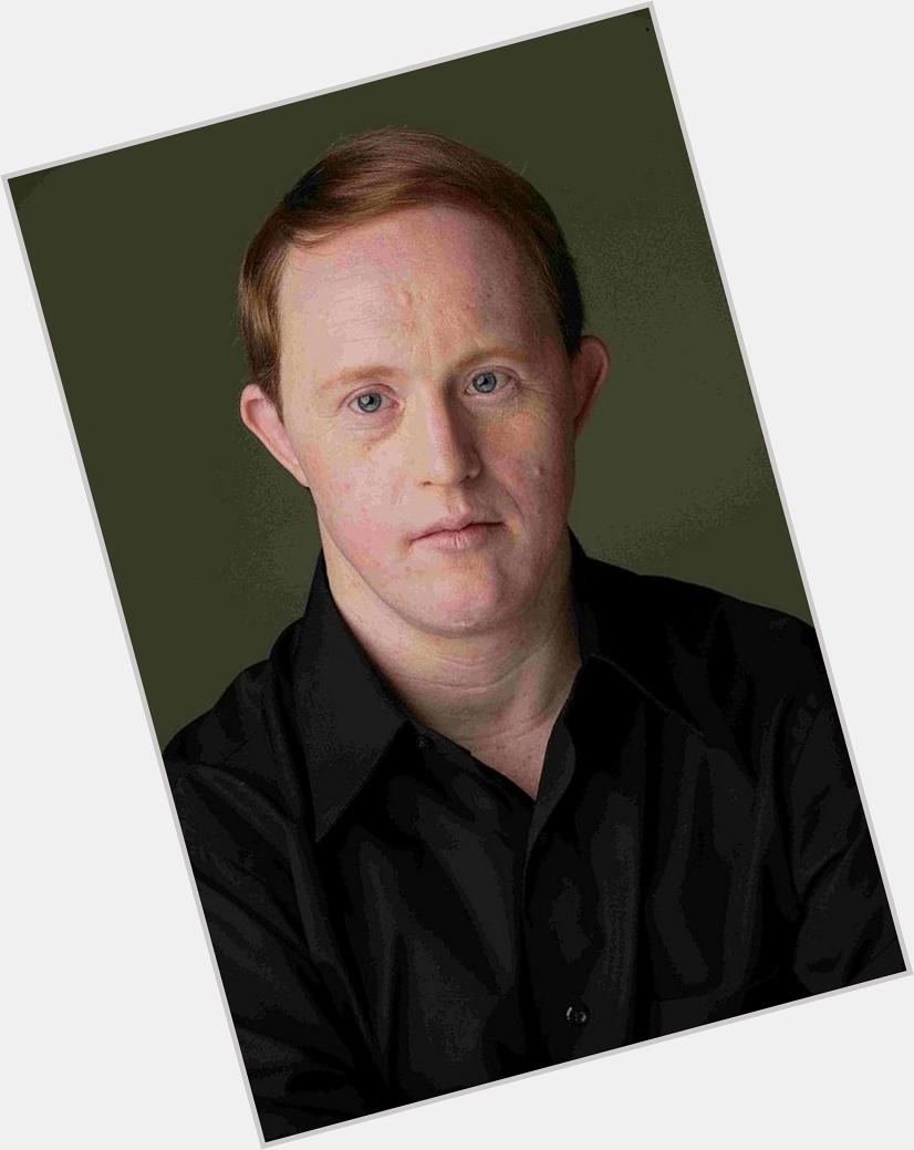 Happy 49th birthday, Chris Burke, the actor (down syndrome) who goes over the limits  