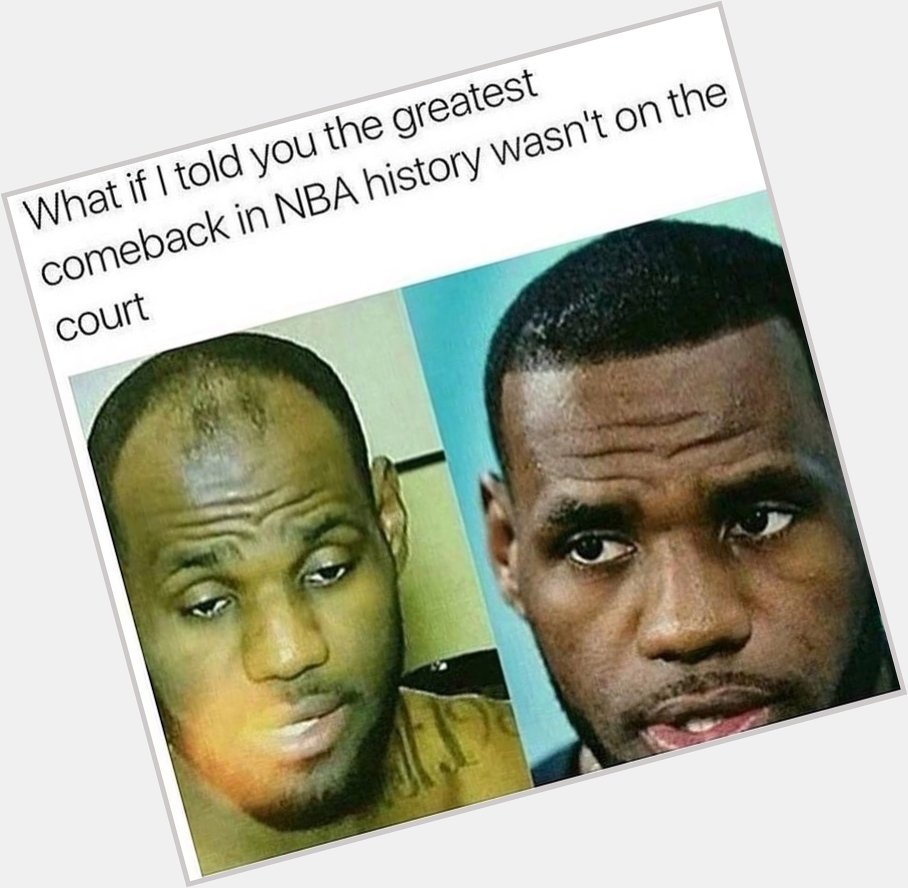 I know I m late to the game, but better late than never. Happy 33rd birthday to Lebron James hairline. 