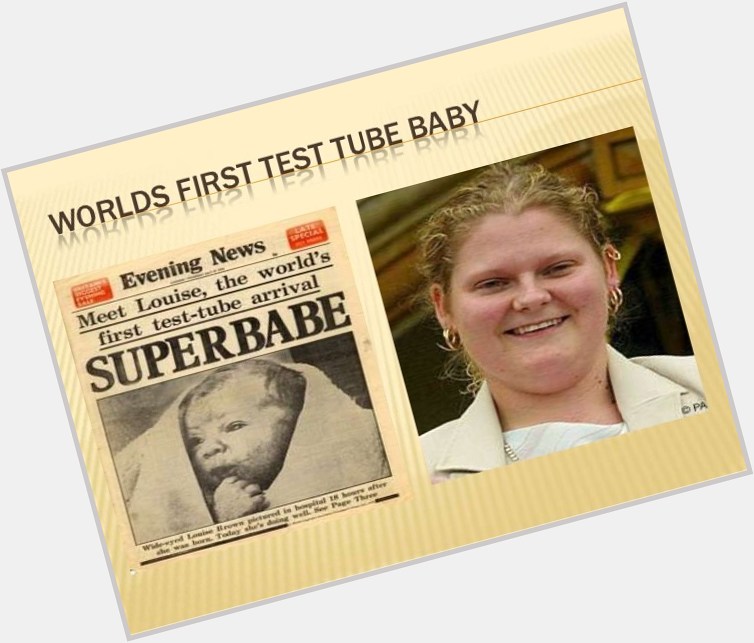 Happy 43rd Birthday to World\s First Test Tube Baby,
Louise Brown.       